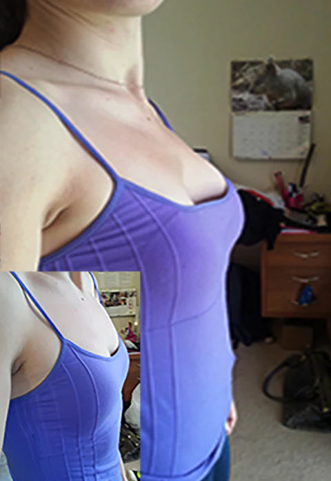 Perkify - Breast Enhancement Patches